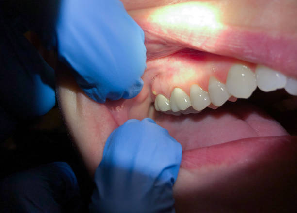 Best Emergency Root Canal Therapy in Arcola, VA