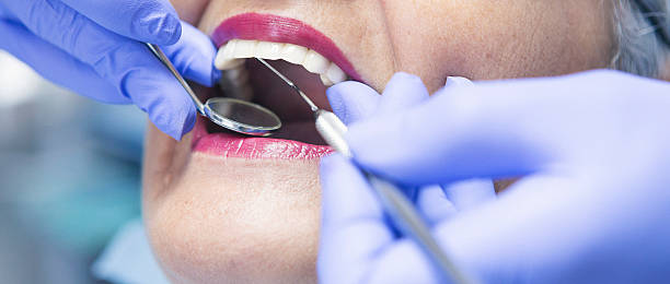 Best Broken or Chipped Tooth Repair in Arcola, VA